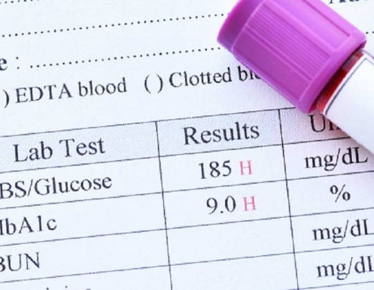 Kiểm soát chỉ số HbA1c đúng cách và bí quyết ổn định chỉ số HbA1c ở người mắc tiểu đường